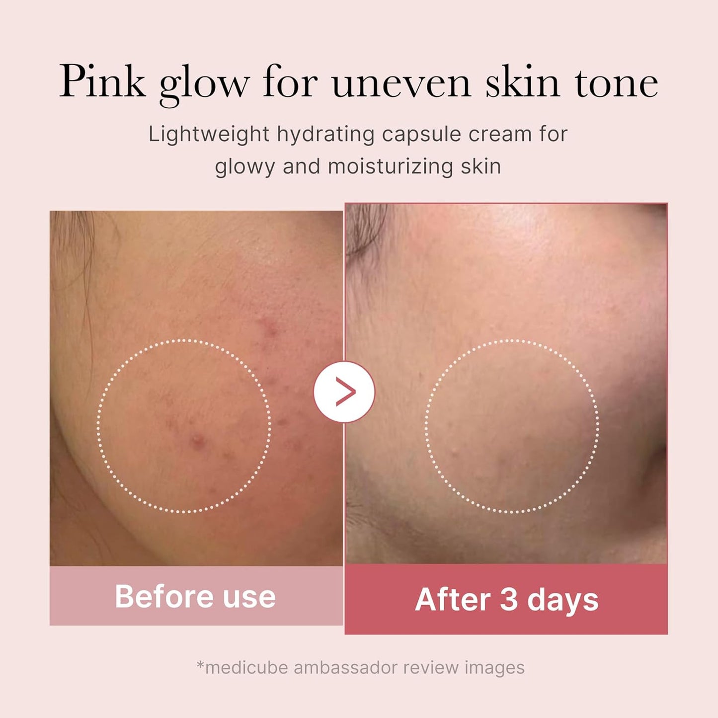 medicube Uneven Skin & Firm Duo: Deep Vitamin C Golden Capsule Face Moisturizer and Salmon DNA PDRN Pink Collagen Capsule Cream